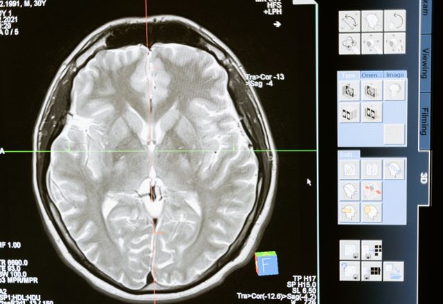 Neurology